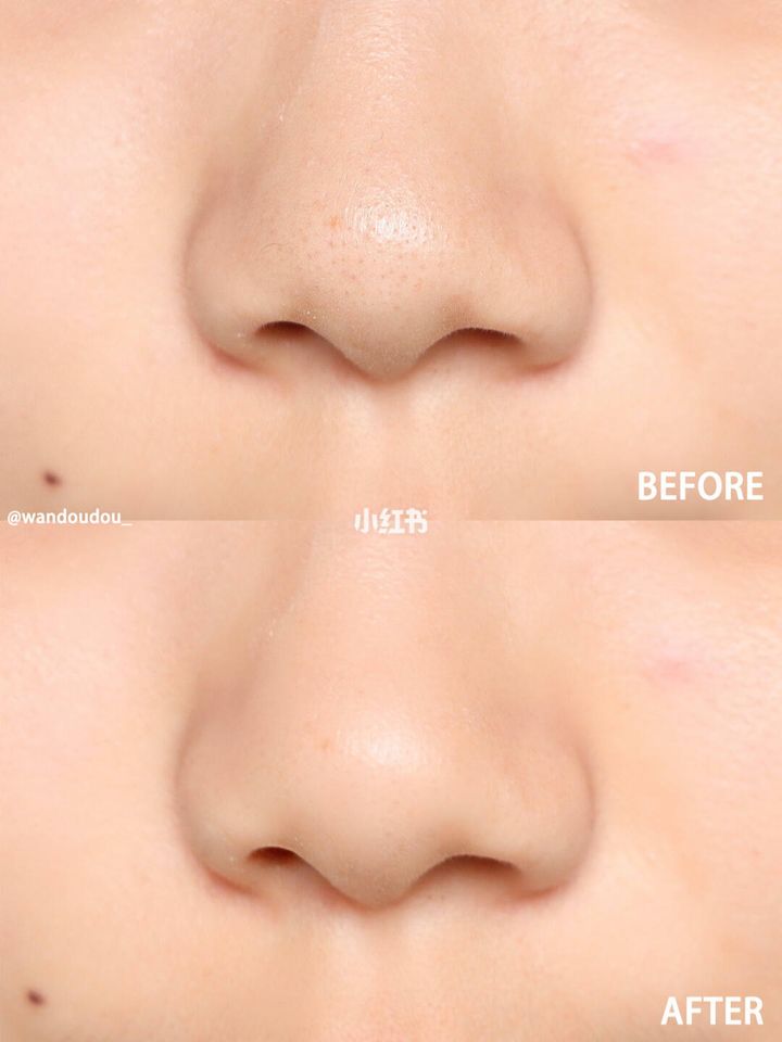 JuzBeauty_JuzBeautyMalaysia_JuzPretty_Authentic_Kbeauty_Jbeauty_Br_lab_Br_Lactobionic_Multi_Enzyme_Ampoule_  (3).jpg
