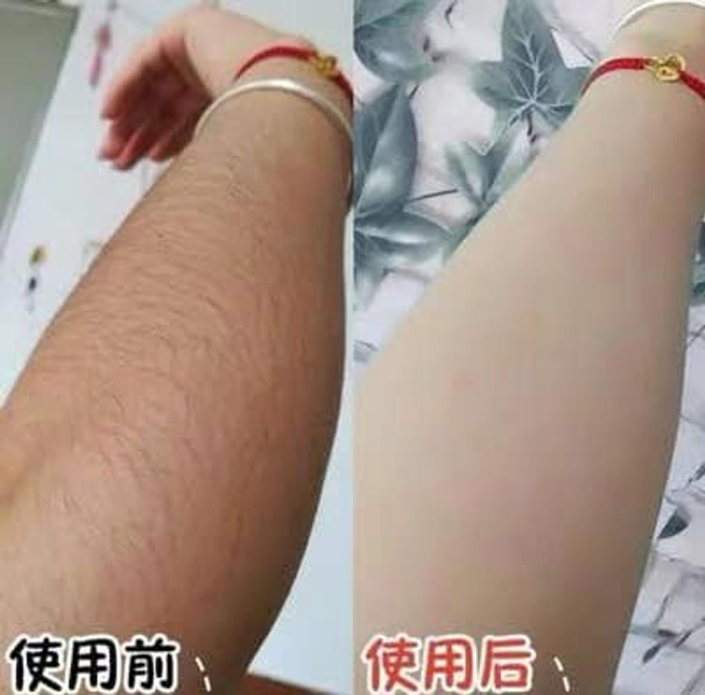 JuzBeauty_JuzBeautyMalaysia_JuzPretty_Authentic_Kbeauty_Jbeauty_IPL_Hair_Removal_Device_ (1).jpg