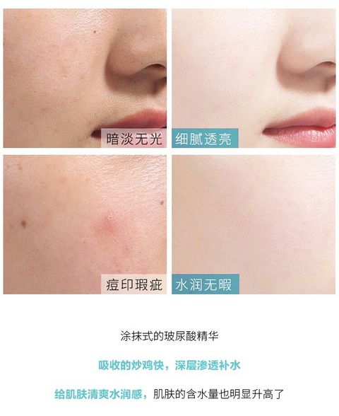 JuzBeauty_JuzBeautyMalaysia_JuzPretty_Authentic_Kbeauty_Jbeauty_AHC_Hyaluronic_Dewy_Radiance_Special_Set_ (9).jpg