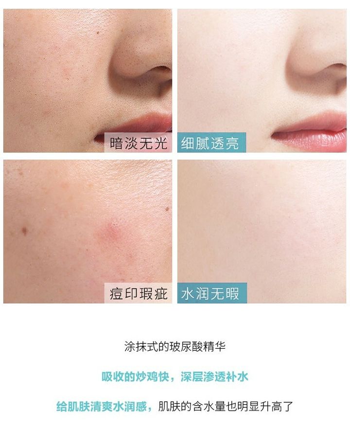 JuzBeauty_JuzBeautyMalaysia_JuzPretty_Authentic_Kbeauty_Jbeauty_AHC_Hyaluronic_Dewy_Radiance_Special_Set_ (9).jpg