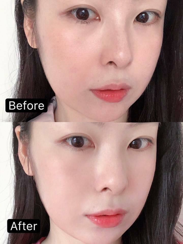 GIK_Cherry_Moist_Volcano_Clean_Mud_Pack_ (4).jpg