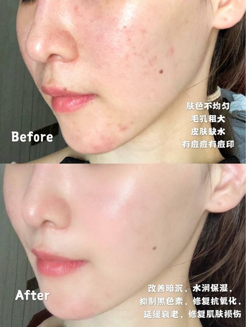 JuzBeauty_JuzBeautyMalaysia_JuzPretty_Authentic_Kbeauty_Jbeauty_GIK_VC_Lift_Mask_ (6).jpg
