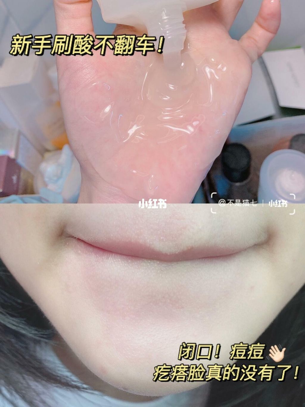 JuzBeauty_JuzBeautyMalaysia_JuzPretty_Authentic_Kbeauty_Jbeauty_EIIO_One_Step_Peeling_Gel_ (10).jpg