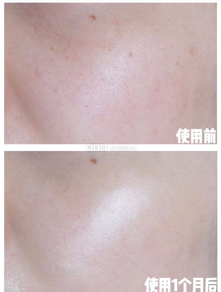 JuzBeauty_JuzBeautyMalaysia_JuzPretty_Authentic_Kbeauty_Jbeauty_AHC_Brilliant_Gold_Essence_ (1).jpg