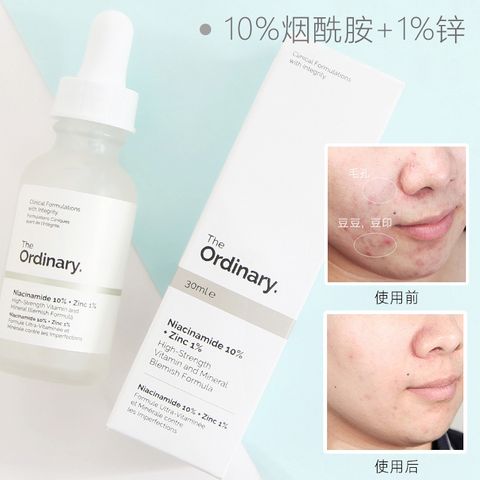 The_Ordinary_Niacinamide_10_Zinc_1 (7).jpg