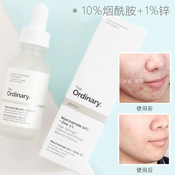 The_Ordinary_Niacinamide_10_Zinc_1 (7).jpg