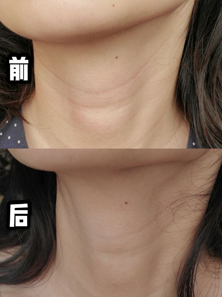 JuzBeauty_JuzBeautyMalaysia_JuzPretty_Authentic_Kbeauty_Jbeauty_The_Ordinary_Argireline_Solution_10_ (3).jpg