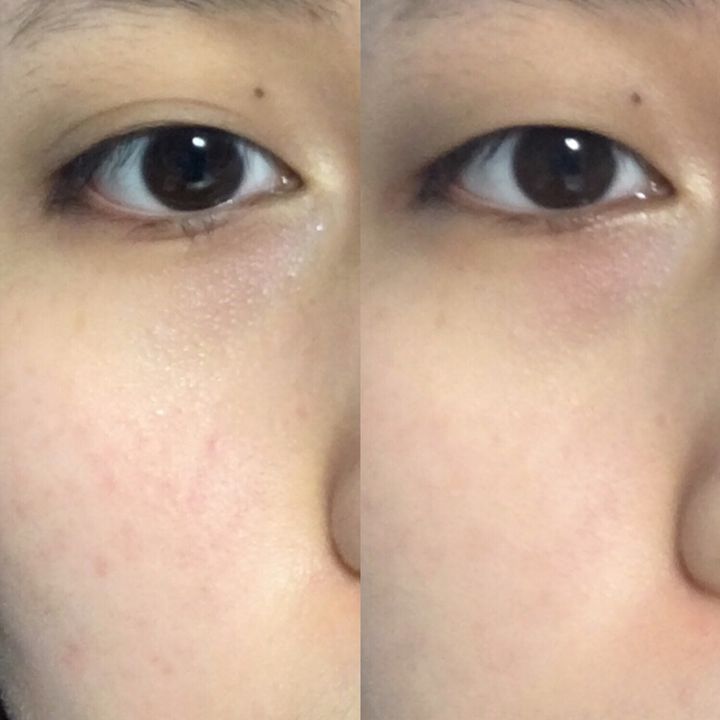 JuzBeauty_JuzBeautyMalaysia_JuzPretty_Authentic_Kbeauty_Jbeauty_The_Ordinary_Azelaic_Acid_Suspension_10_ (9).jpg