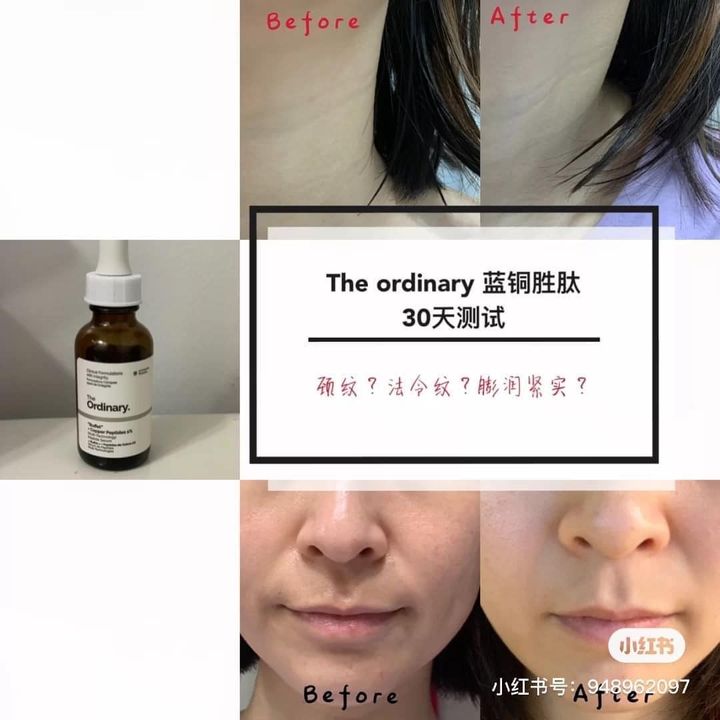 JuzBeauty_JuzBeautyMalaysia_JuzPretty_Authentic_Kbeauty_Jbeauty_The_Ordinary_Buffet_+_Copper_Peptides_1_ (1).jpg