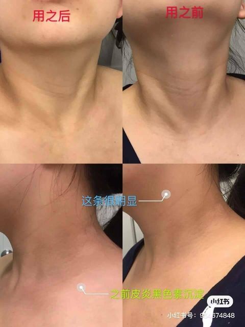 JuzBeauty_JuzBeautyMalaysia_JuzPretty_Authentic_Kbeauty_Jbeauty_The_Ordinary_Buffet_ (8).jpg