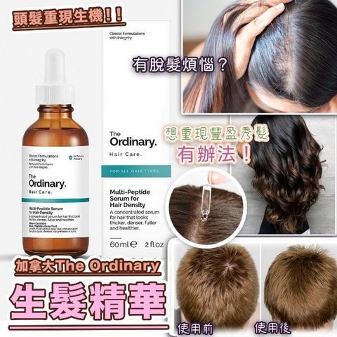 JuzBeauty_JuzBeautyMalaysia_JuzPretty_Authentic_Kbeauty_Jbeauty_The_Ordinary_Multi-Peptide_Serum_For_Hair_Density_ (3).jpg