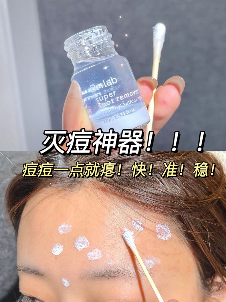 JuzBeauty_JuzBeautyMalaysia_JuzPretty_Authentic_Kbeauty_Malaysia_Jbeauty_Br_Lab_Super_Spot_Remover_ (6).jpg