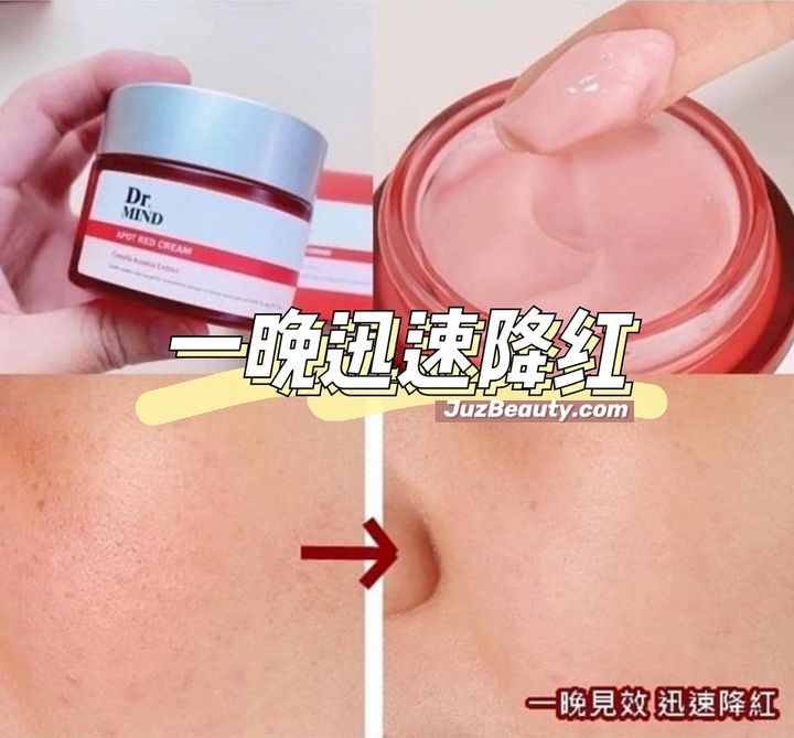JuzBeauty_JuzBeautyMalaysia_JuzPretty_Authentic_Kbeauty_Malaysia_Jbeauty_DrMind_Apot_Red_Cream_ (8).jpg