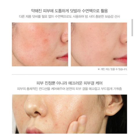 JuzBeauty_JuzBeautyMalaysia_JuzPretty_Authentic_Kbeauty_Malaysia_Jbeauty_DrMind_Apot_Red_Cream_ (9).jpg