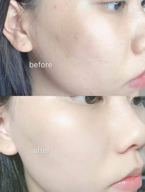 JuzBeauty_JuzBeautyMalaysia_JuzPretty_Authentic_Kbeauty_Malaysia_Jbeauty_DrMind_Apot_Red_Toner_ (4).jpg