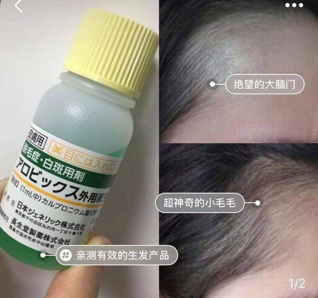 JuzBeauty_JuzBeautyMalaysia_JuzPretty_Authentic_Kbeauty_Malaysia_Jbeauty_JG_Hair_Growth_Tonic_ (9).jpg