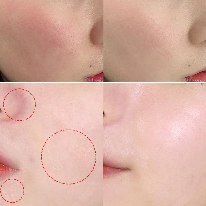 JuzBeauty_JuzBeautyMalaysia_JuzPretty_Authentic_Kbeauty_Malaysia_Jbeauty_RNW_Der_Special_Moisturizing_Repair_Cream_ (2).jpg