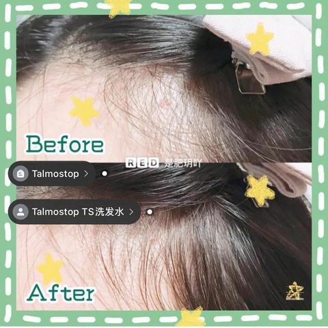 JuzBeauty_JuzBeautyMalaysia_JuzPretty_Authentic_Kbeauty_Malaysia_Jbeauty_TS_Hair_Loss_Prevention_Shampoo_ (11).jpg