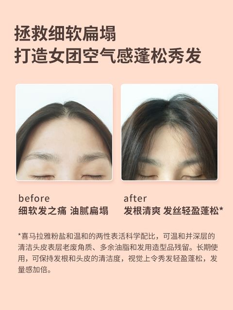 JuzBeauty_JuzBeautyMalaysia_JuzPretty_Authentic_Kbeauty_Malaysia_Jbeauty_Health_Care_Jojozen_Himalayan_Salt_Volumizing_Scrub_Shampoo_ (3).jpg