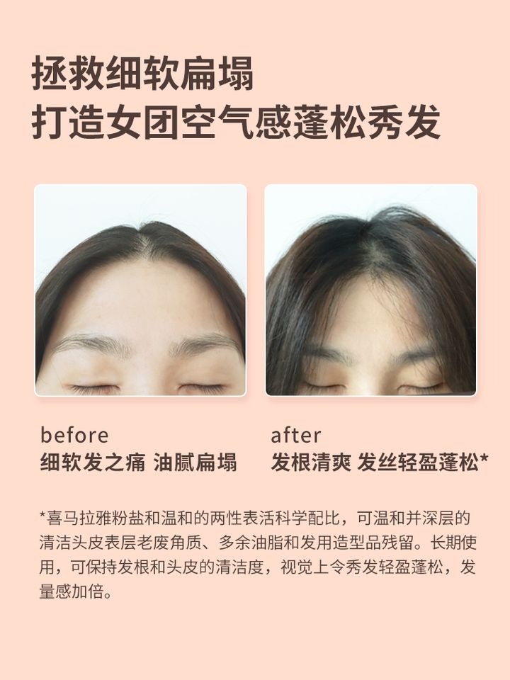JuzBeauty_JuzBeautyMalaysia_JuzPretty_Authentic_Kbeauty_Malaysia_Jbeauty_Health_Care_Jojozen_Himalayan_Salt_Volumizing_Scrub_Shampoo_ (3).jpg