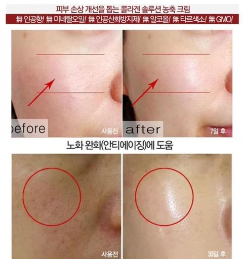 JuzBeauty_JuzBeautyMalaysia_JuzPretty_Authentic_Kbeauty_Malaysia_Jbeauty_Health_Care_Medi-Peel_Hyaluron_Rose_Energy-Tox_Ampoule_Mask_ (13).jpg
