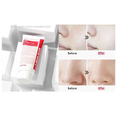 JuzBeauty_JuzBeautyMalaysia_JuzPretty_Authentic_Kbeauty_Malaysia_Jbeauty_Health_Care_Medi-Peel_Red_Lacto_Collagen_Clear_ (2).jpg