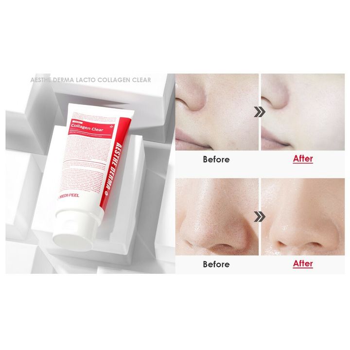 JuzBeauty_JuzBeautyMalaysia_JuzPretty_Authentic_Kbeauty_Malaysia_Jbeauty_Health_Care_Medi-Peel_Red_Lacto_Collagen_Clear_ (2).jpg
