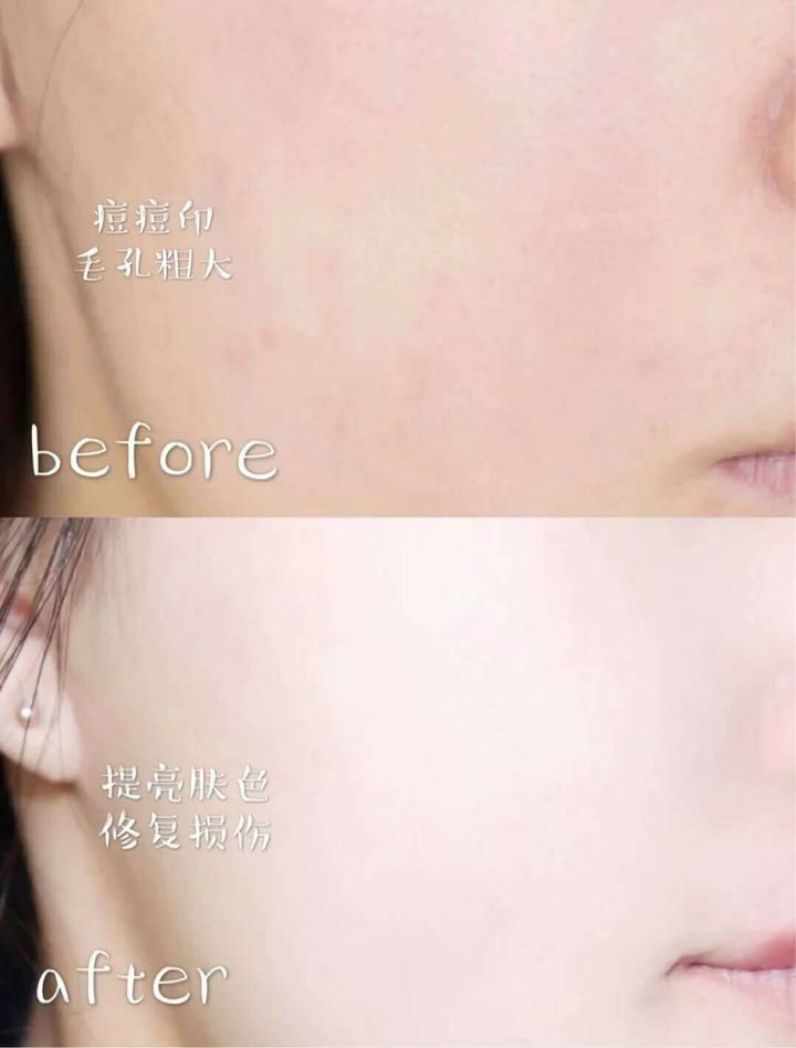 JuzBeauty_JuzBeautyMalaysia_JuzPretty_Authentic_Kbeauty_Malaysia_Jbeauty_Health_Care_AmpleN_Peptide_Shot_Ampoule_ (2).jpg