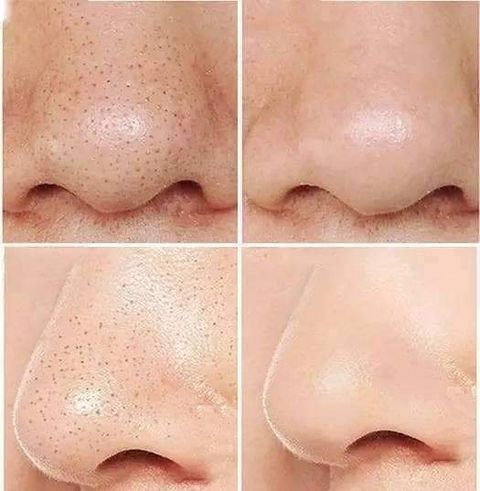 JuzBeauty_JuzBeautyMalaysia_JuzPretty_Authentic_Kbeauty_Malaysia_Jbeauty_Health_Care_RiRe_All_Kill_Blackhead_Brush_Cleanser_ (4).jpg