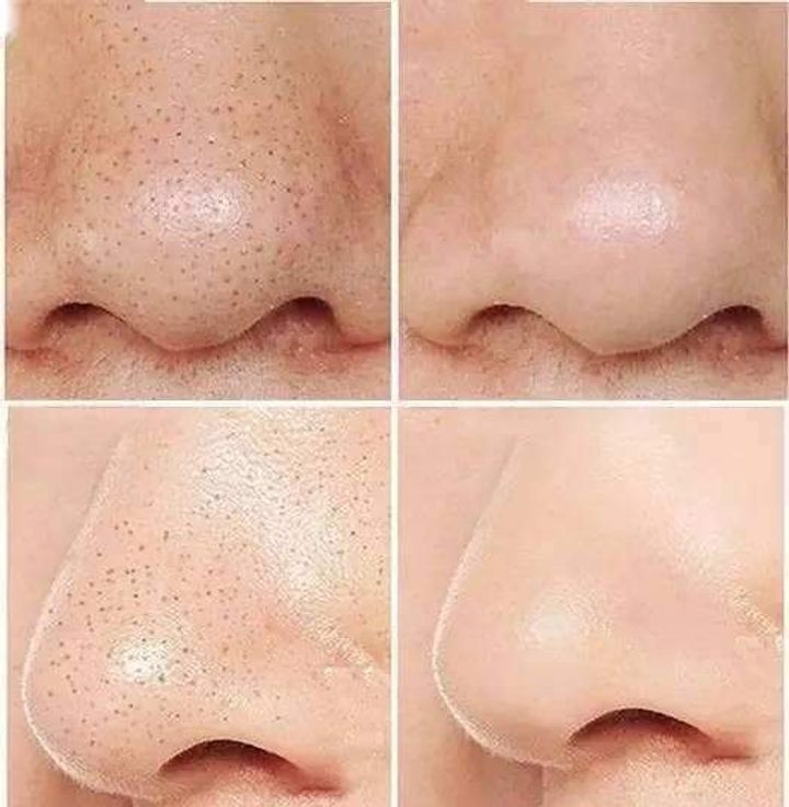 JuzBeauty_JuzBeautyMalaysia_JuzPretty_Authentic_Kbeauty_Malaysia_Jbeauty_Health_Care_RiRe_All_Kill_Blackhead_Brush_Cleanser_ (4).jpg