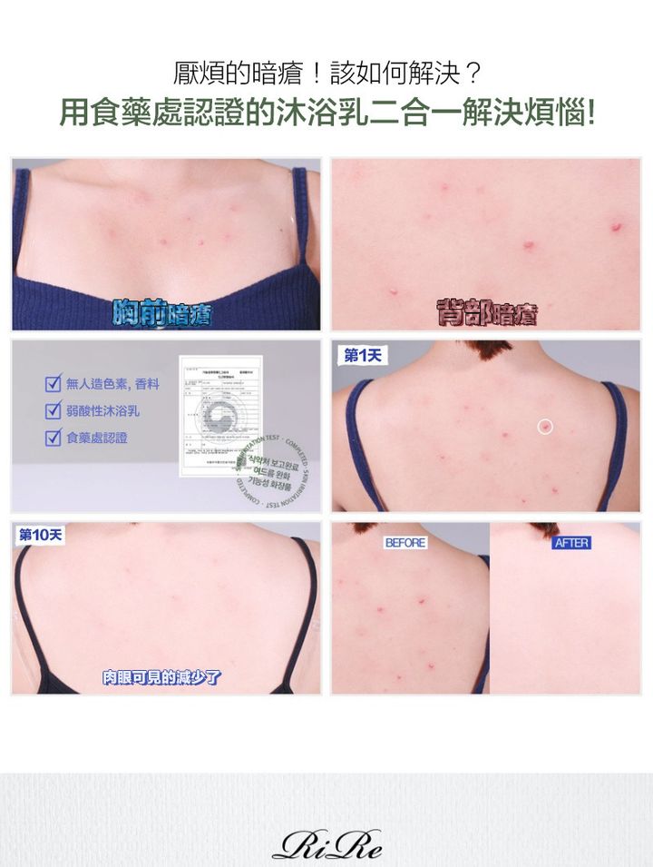 JuzBeauty_JuzBeautyMalaysia_JuzPretty_Authentic_Kbeauty_Malaysia_Jbeauty_Health_Care_RiRe_All_Kill_Acne_Cleanser_ (3).jpg