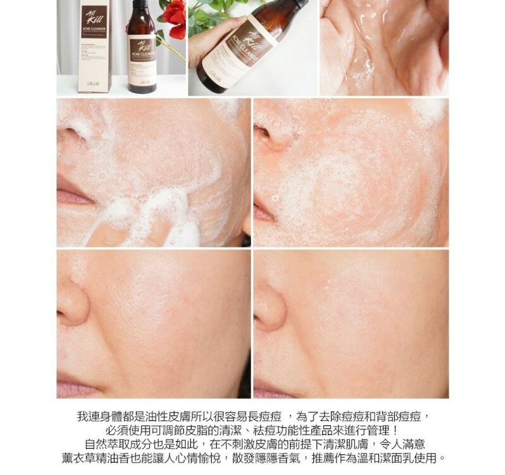 JuzBeauty_JuzBeautyMalaysia_JuzPretty_Authentic_Kbeauty_Malaysia_Jbeauty_Health_Care_RiRe_All_Kill_Acne_Cleanser_ (8).jpg