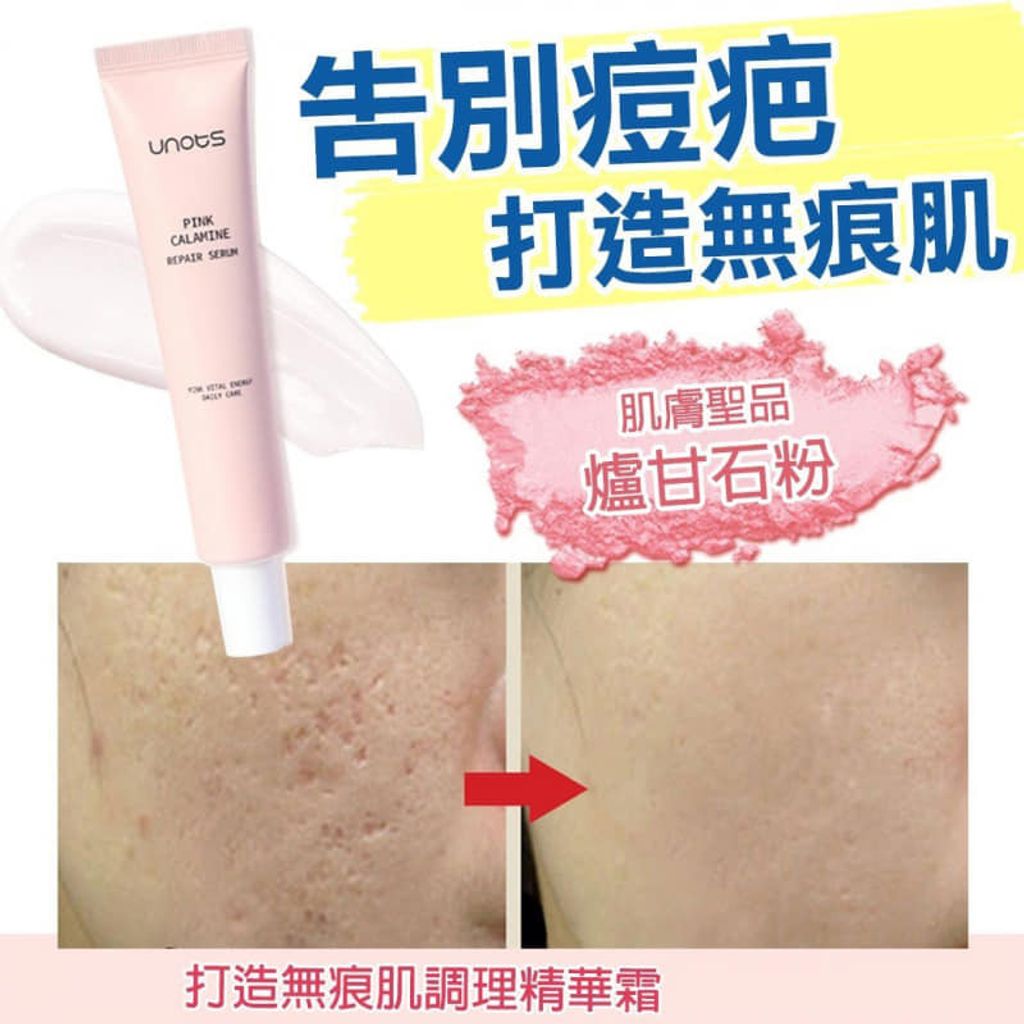 JuzBeauty_JuzBeautyMalaysia_JuzPretty_Authentic_Kbeauty_Malaysia_Jbeauty_Health_Care_Unots_Pink_Calamine_Repair_Serum_ (5).jpg