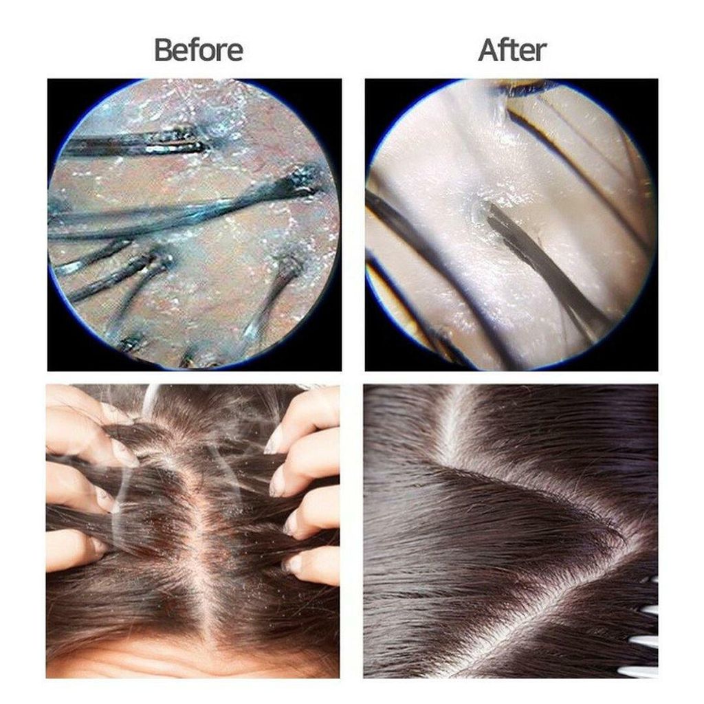 JuzBeauty_JuzBeautyMalaysia_JuzPretty_Authentic_Kbeauty_Malaysia_Jbeauty_Health_Care_HAIRPLUS_Oh_Fresh_Deep_Herbal_Scalp_Scaling_ (2).jpg