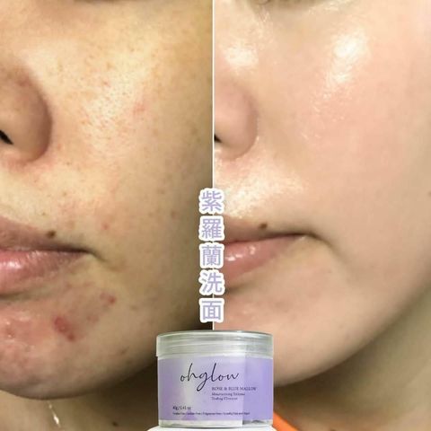 JuzBeauty_JuzBeautyMalaysia_JuzPretty_Authentic_Kbeauty_Malaysia_Jbeauty_Health_Care_ohglow_Enzyme_Tea_Bag_Cleanser_ (6).jpg