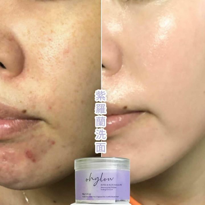 JuzBeauty_JuzBeautyMalaysia_JuzPretty_Authentic_Kbeauty_Malaysia_Jbeauty_Health_Care_ohglow_Enzyme_Tea_Bag_Cleanser_ (6).jpg