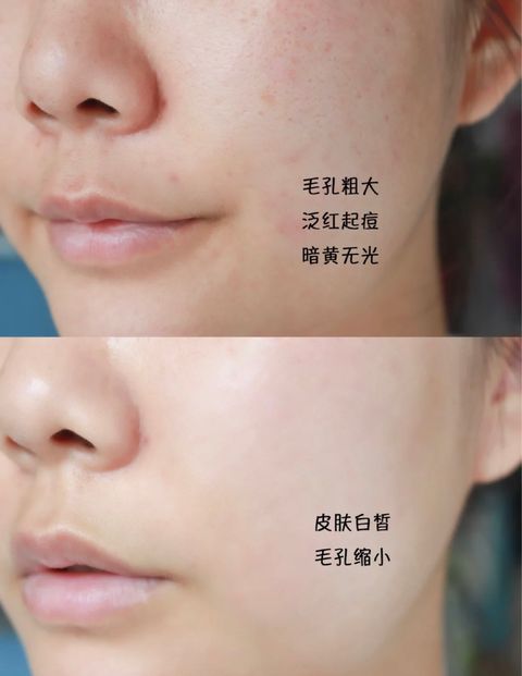 JuzBeauty_JuzBeautyMalaysia_JuzPretty_Authentic_Kbeauty_Malaysia_Jbeauty_Health_Care_Trilogy_Rosehip_Oil_Antioxidant_ (2).jpg