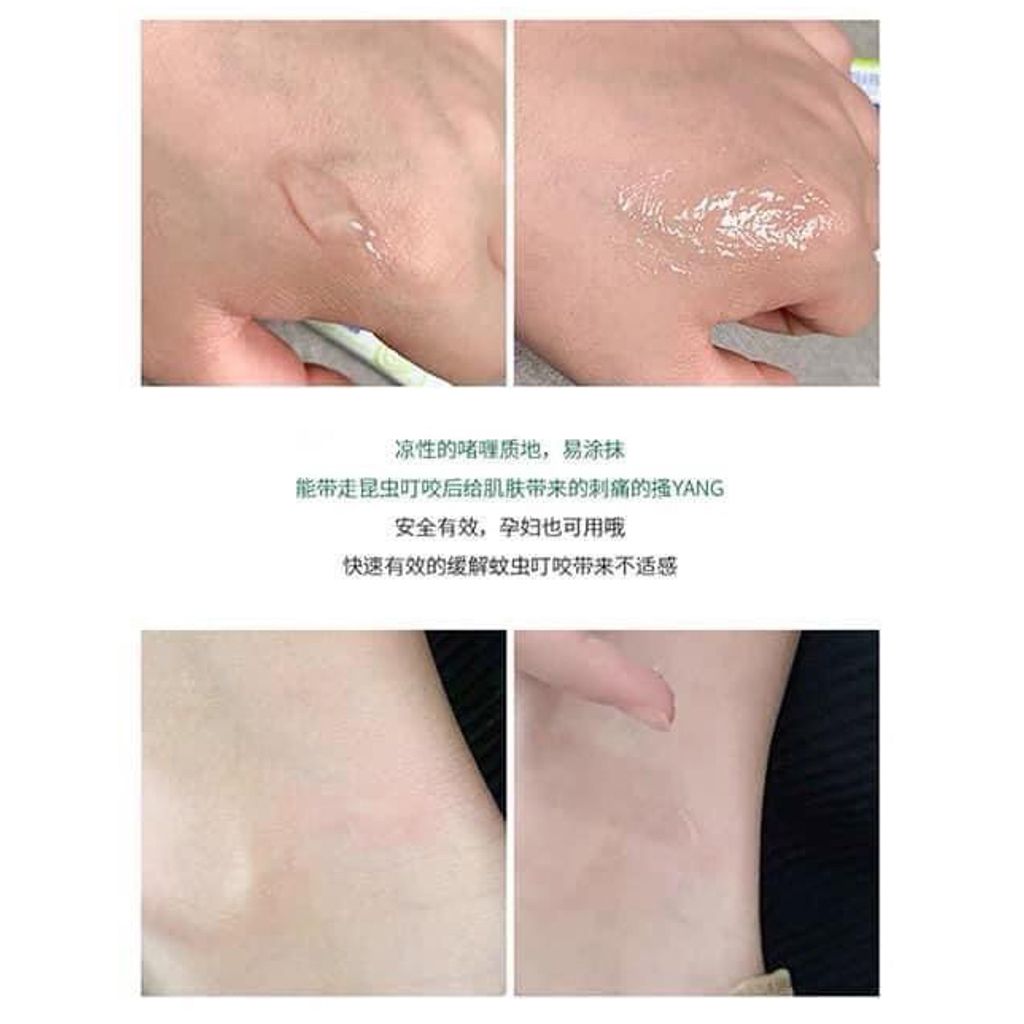 JuzBeauty_JuzBeautyMalaysia_JuzPretty_Authentic_Kbeauty_Malaysia_Jbeauty_Australia_Health_Care_Ego_Soov_Bite_ (4).jpg