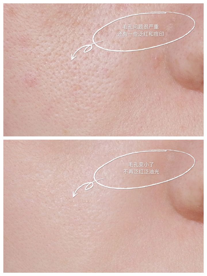 JuzBeauty_JuzBeautyMalaysia_JuzPretty_Authentic_Kbeauty_Malaysia_Jbeauty_Australia_Health_Care_Acqua_Distillata_Alle_Rose_Rose_Water_ (14).jpg