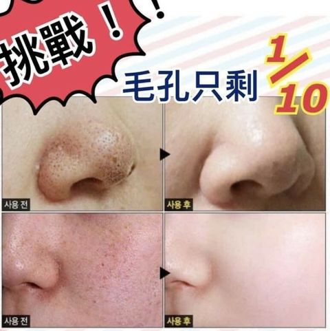 JuzBeauty_JuzBeautyMalaysia_JuzPretty_Authentic_Kbeauty_Malaysia_Jbeauty_Australia_Health_Care_Aromame_Skin_Care_Solution_Pore_Tox_Serum_ (3).jpg