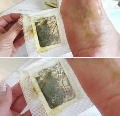 JuzBeauty_JuzBeautyMalaysia_JuzPretty_Authentic_Kbeauty_Malaysia_Jbeauty_Australia_Health_Care_MURO_Balgus_Von_Patch_ (2).jpg
