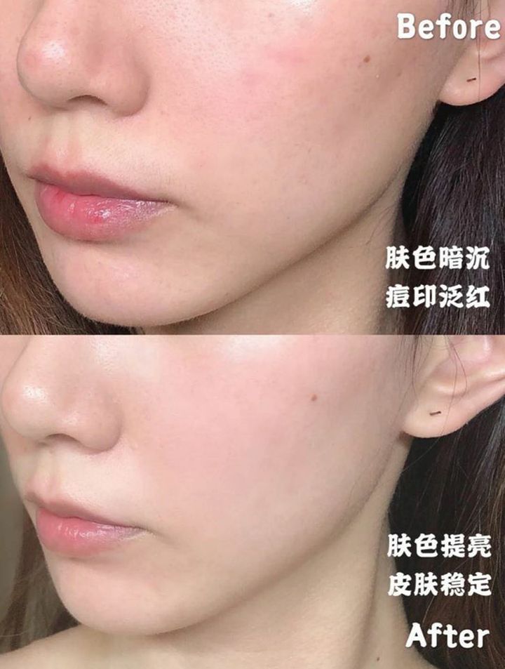 JuzBeauty_JuzBeautyMalaysia_JuzPretty_Authentic_Kbeauty_Malaysia_Jbeauty_Australia_Health_Care_Rapern_8_Star_Mask_Sheet_ (12).jpg