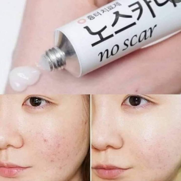 JuzBeauty_JuzBeautyMalaysia_JuzPretty_Authentic_Kbeauty_Malaysia_Jbeauty_Australia_Health_Care_Noscarna_Gel_ (4).jpg