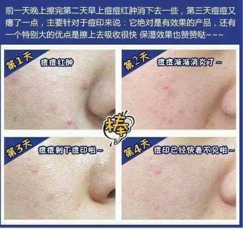 JuzBeauty_JuzBeautyMalaysia_JuzPretty_Authentic_Kbeauty_Malaysia_Jbeauty_Australia_Health_Care_23_Years_Old_Badecasil_P-Original_ (1).jpg