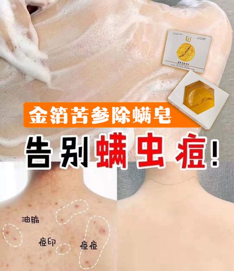 JuzBeauty_JuzBeautyMalaysia_JuzPretty_Authentic_Kbeauty_Malaysia_Jbeauty_Australia_Health_Care_FU_Ginseng_Anti-Mite_Soap_ (1).jpg