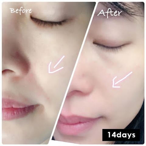 JuzBeauty_JuzBeautyMalaysia_JuzPretty_Authentic_Kbeauty_Malaysia_Jbeauty_Australia_Health_Care_Obagi_Derma_Power_X_Inner_Lift_Drink_ (5).jpg