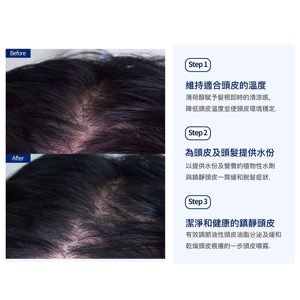 JuzBeauty_JuzBeautyMalaysia_JuzPretty_Authentic_Kbeauty_Malaysia_Jbeauty_Australia_Health_Care_Cosnori_8grow_Anti_hairloss_Pro-vit_B5_Hair_Tonic_ (3).jpg