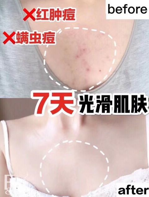 JuzBeauty_JuzBeautyMalaysia_JuzPretty_Authentic_Kbeauty_Malaysia_Jbeauty_Australia_Health_Care_FU_Hibiscus_Flowers_Spray_ (32).jpg