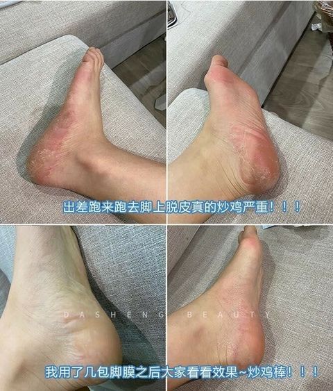 JuzBeauty_JuzBeautyMalaysia_JuzPretty_Authentic_Kbeauty_Malaysia_Jbeauty_Australia_Health_Care_The_Orchid_Skin_Hand_Mask_Foot_Mask_ (8).jpg