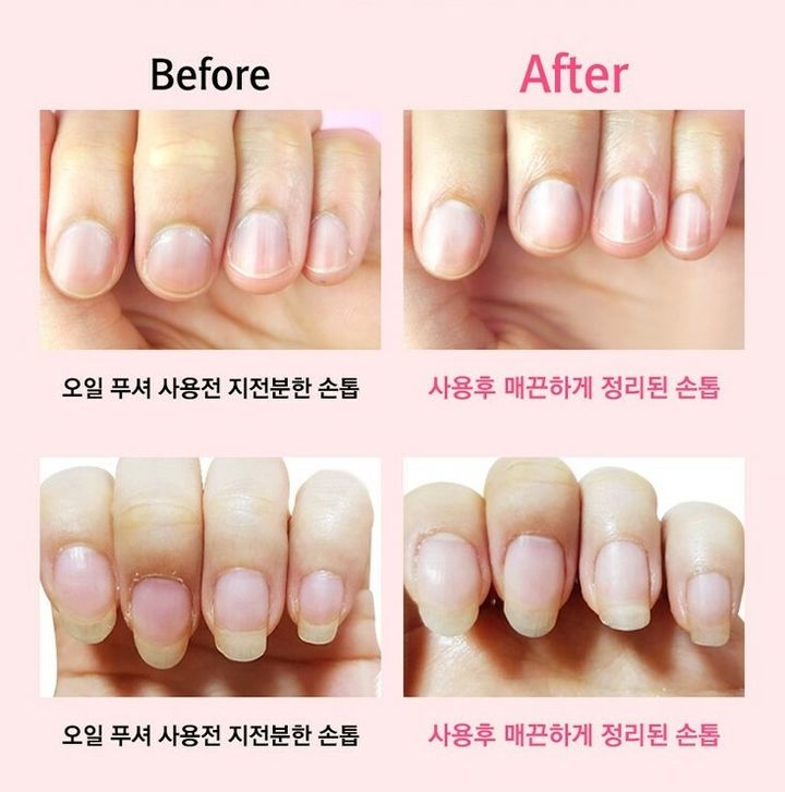 JuzBeauty_JuzBeautyMalaysia_JuzPretty_Authentic_Kbeauty_Malaysia_Jbeauty_Australia_Health_Care_RiRe_Miracle_Cuticle_Oil_Pusher_ (7).jpg